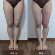 セルライトケア下半身集中コース60分エステ