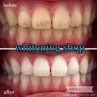 【都度払いケア】2回目以降の方 40分照射 ¥6,980