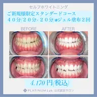 ご新規様限定🦷スタンダードコース40分(20分×2)✨メンズも大歓迎✨！☝️