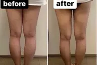 お試し【痩身】60分