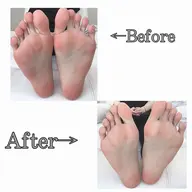 フットケアコース🫧【自爪の方限定】角質ケア&ウォーターケア付き🌿