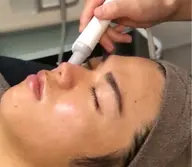 男性限定 眉ワックス&鼻の毛穴エステコース