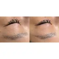 ハリウッドブロウリフト