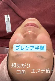 3カ月で肌結果を!ホームケアとエステのコラボで必ずお肌がきれいに!