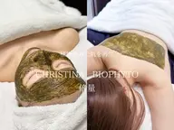 《ニキビ・毛穴詰まり改善》倍量ハーブピーリング｜ビオフィート｜顔or背中