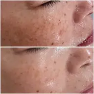 🈹60%off✨水光肌✨モデリングパック付き💆♀️最強肌質改善フェイシャル80分