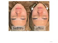 一回で変わる‼️引き上げフォト+韓国式最新水流毛穴洗浄ケア🔥