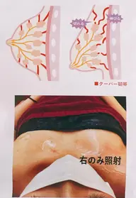 バストアップ　ハイ　フォーカスデコルテ◎ ハリ　コラーゲン！ふっくらバストへ＊