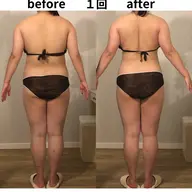 全身燃焼デトックス痩身120分🔥ラジオ波×痩身ハンドで全身むくみ・セルライト徹底ケア