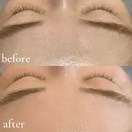 【透明感UP✨ツヤツヤ肌へ】フルフェイシャルワックス¥5400