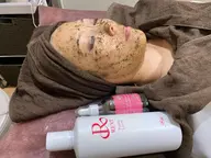 ハーブピーリング