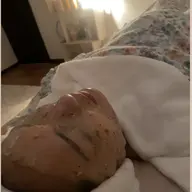 ハイドロジェリーマスク（オプション）