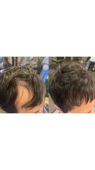 薄毛専用カット＋薄毛無料カウンセリング