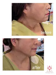 小顔エイジングフェイシャルマッサージ　シルバー60分