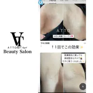 大人気メニュー♪ワキ脱毛！！一回から効果実感！