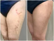 【美脚・術後ケア】むくみもピーマン尻も!下半身絞り上げ痩身ケア60分