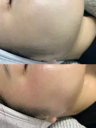 驚きの触り心地！【全顔】フェイスワックス