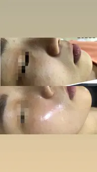 【K beauty center式美小顔】小顔コルギ+再生ケア+石膏パック+悩み別肌管理90分