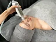 【初回限定】サーマクール［たるみ・しわ/小顔/ハリ・ツヤ/リフトアップ効果💎］