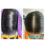 初回体験コース:ファインバブルで頭皮洗浄＋プラズマ機械で頭皮余分の皮脂除去＋炭酸ミストで血流促進＋毛根＋毛の密度観察