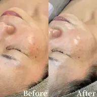 美白・保湿ケアコース(デコルテマッサージ付き)メンズもお試しください★