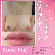 【大人気👑ローマピンク🩷今月特別案内あと3名】気になる黒ずみ悩みはまずカウンセリングへ♪特別プレゼントあり💝