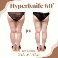 《ミニモ学割》U24  60分ハイパーナイフ◇上半身or下半身