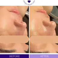 【ミニモ限定】大人気光フェイシャル➕美肌モデパック付 ➕デコルテマッサージ　45分