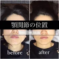 Z minimo限定❣️人気急上昇💕あご💆🏻♀️+瞬間【首肩腰骨盤/全身矯正】顎と全身の歪み