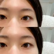 上下まつげパーマ〈コーティング付〉¥6,500＋指名料¥300 ※オフ不可※