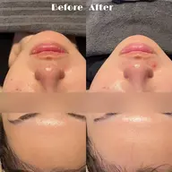 【乾燥撃退⛄️】高保湿トリートメント💫🎀