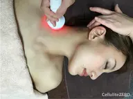 【小顔引き上げ】ラジオ波フェイシャル