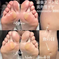 👣フットつらい魚の目、タコケアそれぞれ2箇所まで(ネイルケア込み)