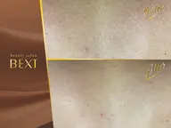 【結果重視】全身脱毛＋VIO＋うなじ＋顔（レディース）or ヒゲ（メンズ）｜痛みが不安な方にも◎名古屋駅・ささしま近く