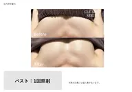 ふっくらバストケア