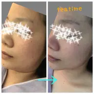 モニター募集　美肌＆整体エステ