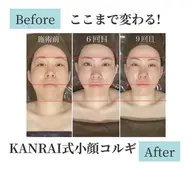 【自分史上No.１の小顔に】小顔コルギ➕上半身コルギ　※SNS掲載OKの方（施術時間45分）