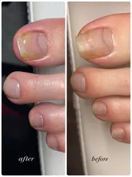 4/17 12:00〜限定【フット】自爪ケア&角質ケア💅Googleへの口コミもお願いします🙏