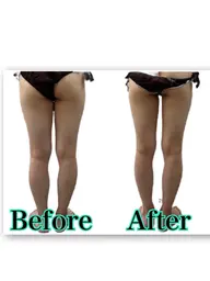 針を使わない脂肪撃退10ml✨ 💕選べるお身体1部位専用💕