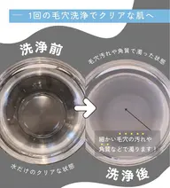 今だけ！【毛穴トラブル・ニキビ・皮脂ベタつき・シミ・しわ】超音波毛穴洗浄➕ビタミンCE導入付き