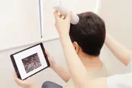 【男性女性年齢問わず】マイクロスコープ頭皮診断 無料