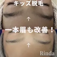 体毛でお悩みのお子様に【キッズ全身脱毛10歳～12歳年齢別限定】痛みが少ない全身美肌脱毛