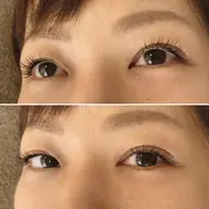 140本コース（アイシャンプー付き）オフ無料