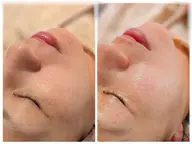 話題の最新美容導入120分15000円