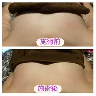 【特別料金】バストアップ45分