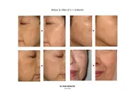 肌質改善プログラム体験コース《2回分》