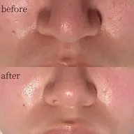 【先着10名】毛穴・くすみケア◎フェイスワックス体験✨透明感UP/相模大野