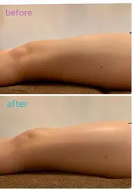 膝上お肉撃退!! 全身リンパマッサージ+膝上スッキリコース