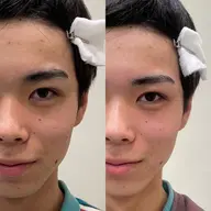 美容室で出来る✨アイブロウパーマ＋ワックス脱毛＋眉カット＋眉メイク🫧眉のお悩みやなりたい形、似合う形をご提案します🕊