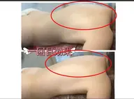 【痩身人気 No.1】痩身+全身アロマリンパマッサージ130分¥12,900